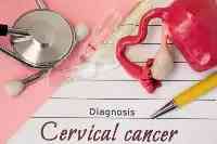 22歲靚女查出宮頸癌，先後流產2次！提醒：患病前，一般有2個徵兆