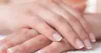 1藥網：指甲出現豎紋是疾病的訊號？關於指甲的秘密，一次說清楚